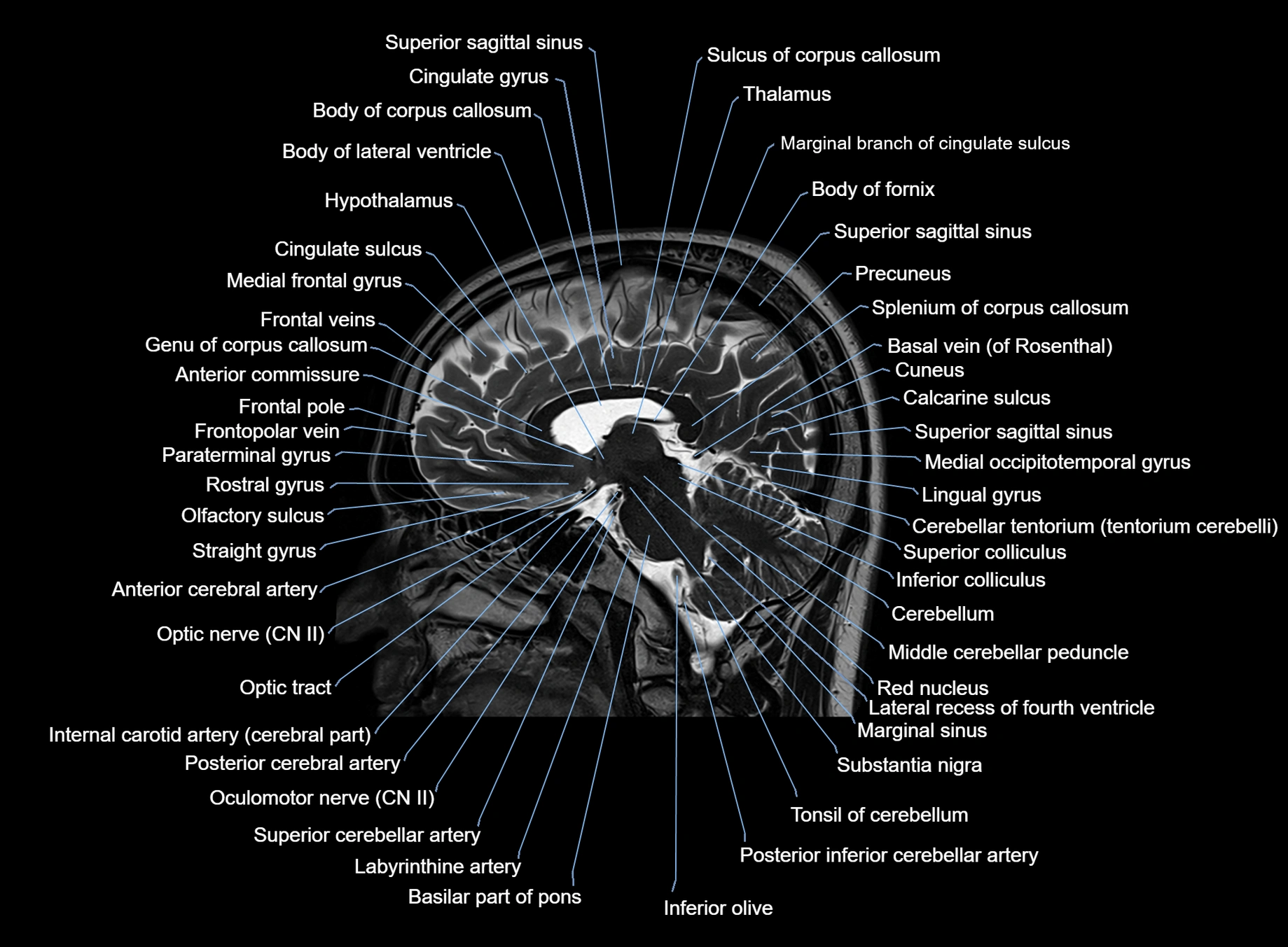 brain sagittal anatomy 3T MRI images -img-00001-00031.webp